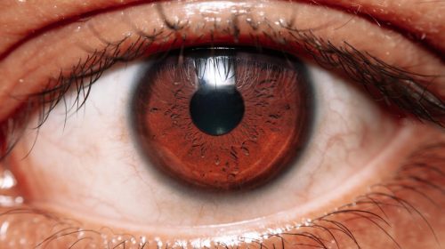 Ojo seco: La importancia de llevar una corrección adecuada en gafas o lentes de contacto