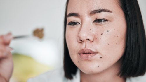 Cinco errores que cometemos con la piel sin darnos cuenta y cómo solucionarlos de forma natural.