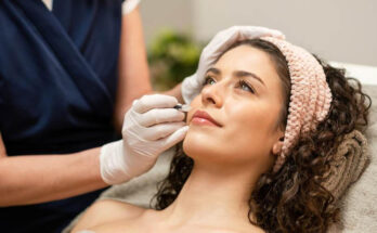 Diferencias entre rellenos faciales: ¿mejor con ácido hialurónico o un lipolifting?