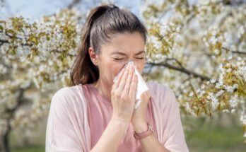 ¿Tienes alergia al polen? Tratamientos de medicina estética que debes evitar
