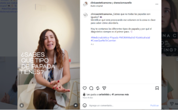 No todas las papadas son iguales: qué tipo tienes y cuál es el tratamiento más adecuado